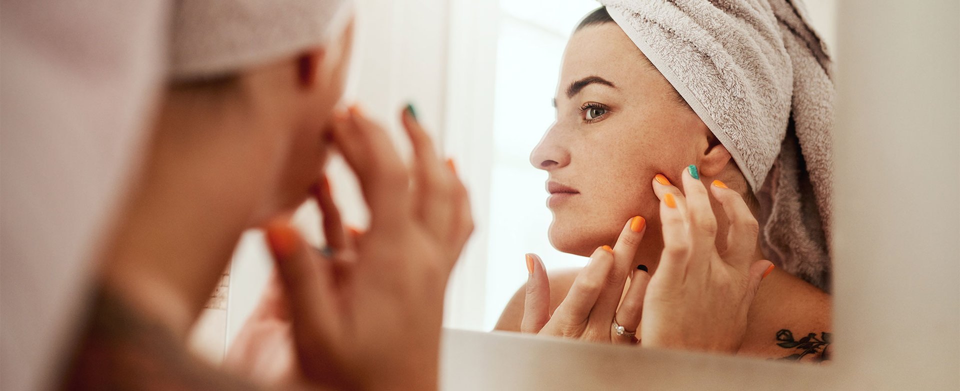 Jak Na Akne V Dospelosti