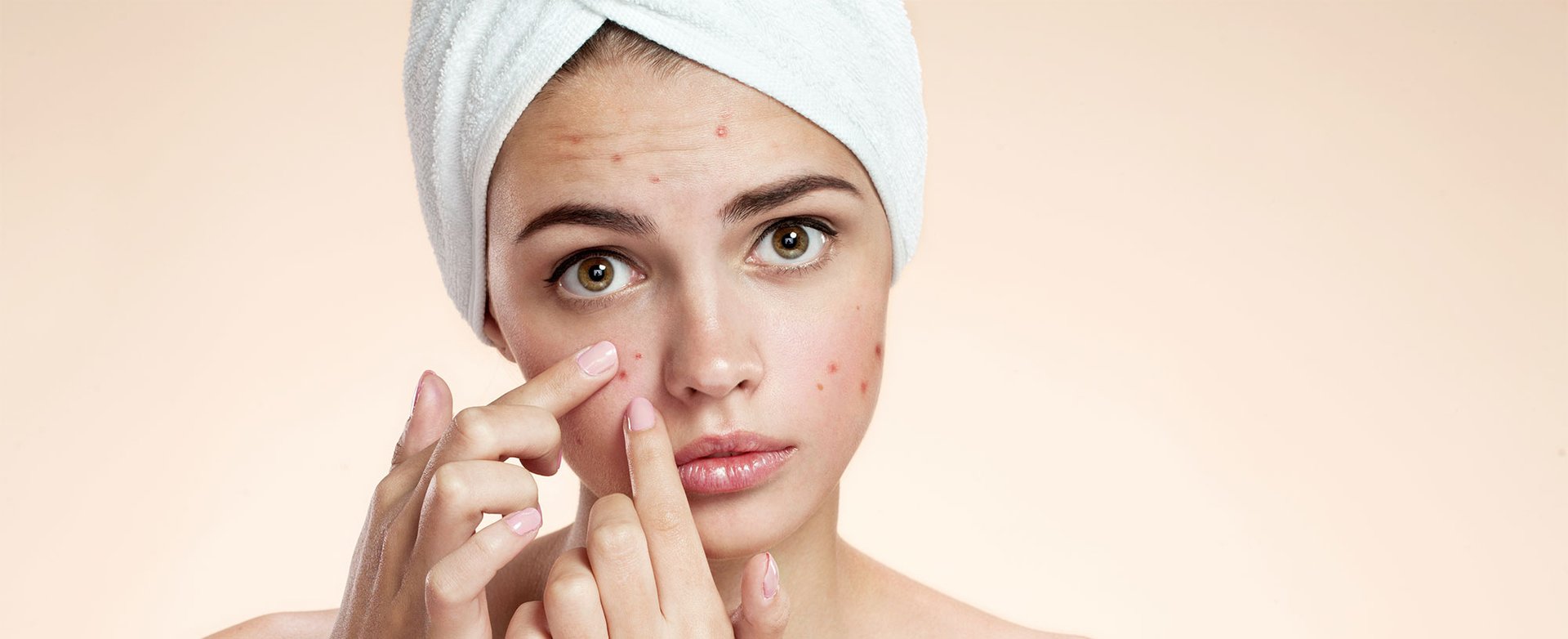 Jak Se Ucinne Zbavit Akne