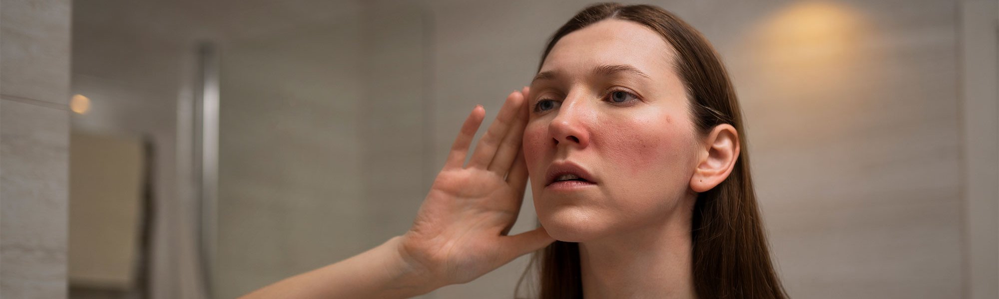 Jak Se Zbavit Cervenych Skvrn Na Tvari A Zklidnit Plet