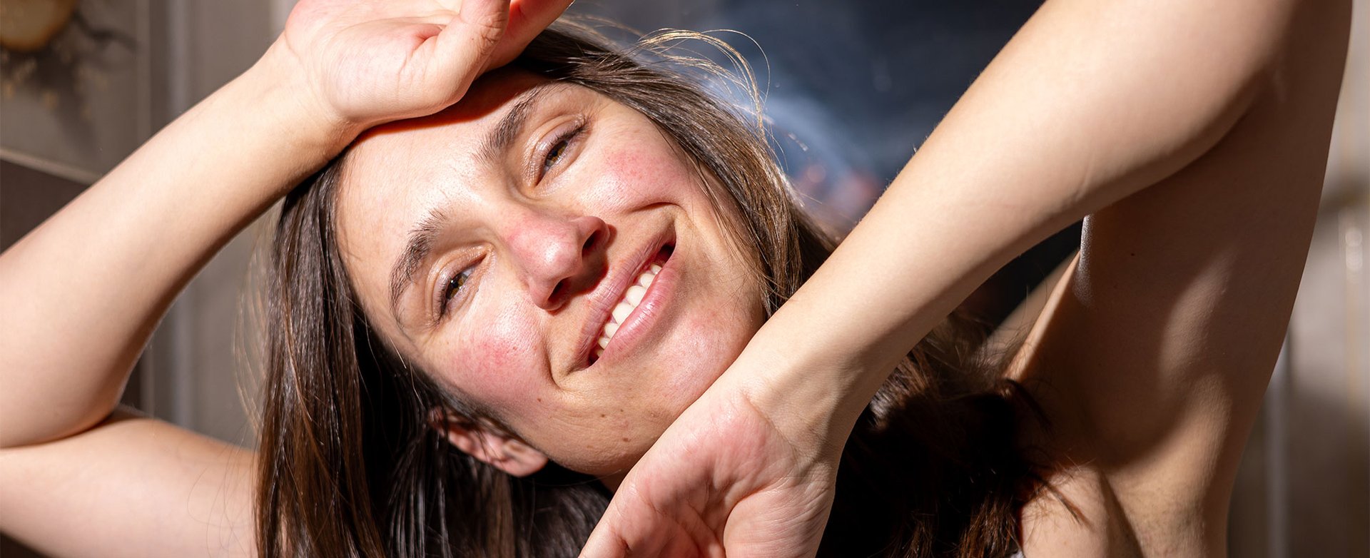 Rosacea Nemusi Byt Videt