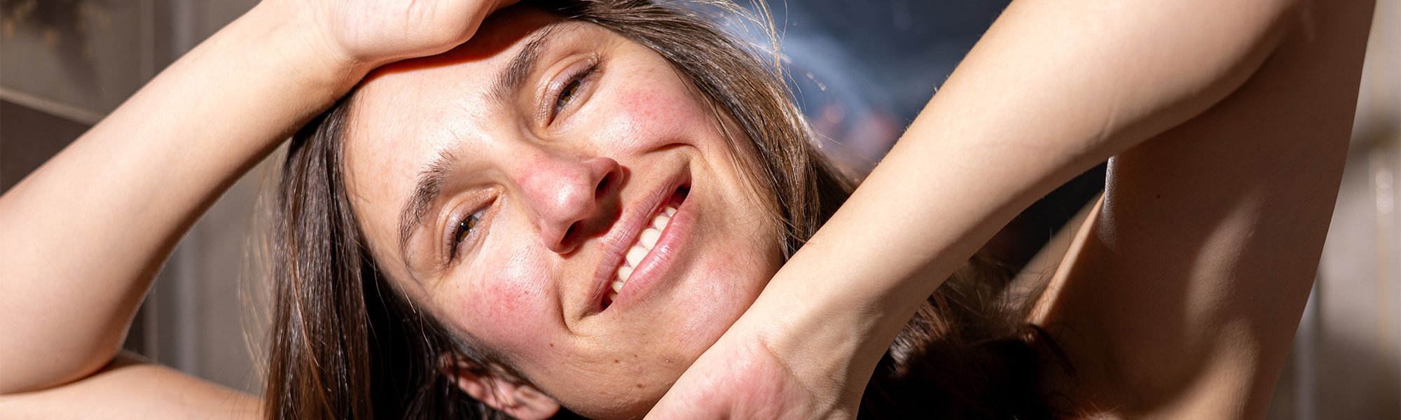 Rosacea Nemusi Byt Videt
