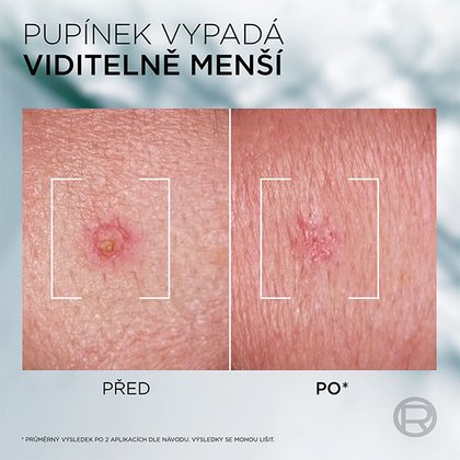 3600524188672 02 Cz