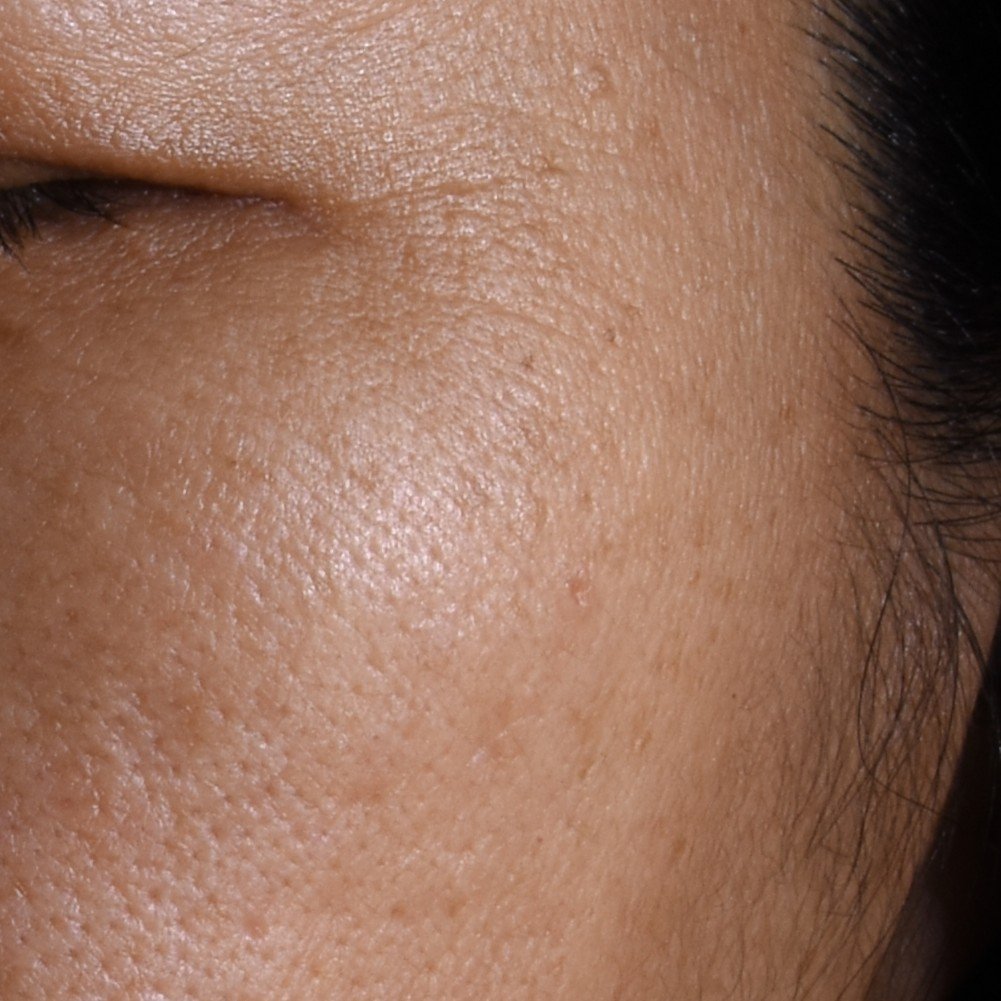 20251105 Oap Revitalift Laser Melasyl Creamy Serum After Dmi Ecomm Img 1000x1000